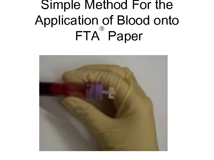 Simple Method For the Application of Blood onto ® FTA Paper 