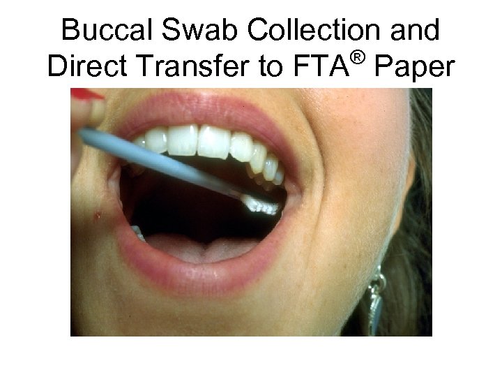 Buccal Swab Collection and ® Direct Transfer to FTA Paper 