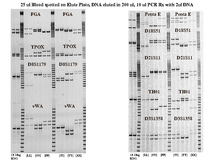 25 ul Blood spotted on Elute Plate, DNA eluted in 200 ul, 10 ul