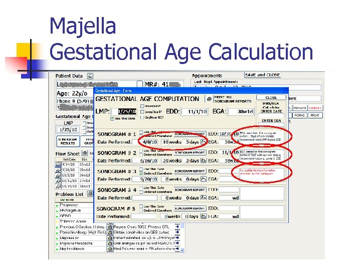 Majella Gestational Age Calculation 