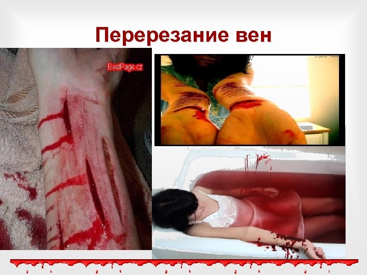 Перерезание вен 