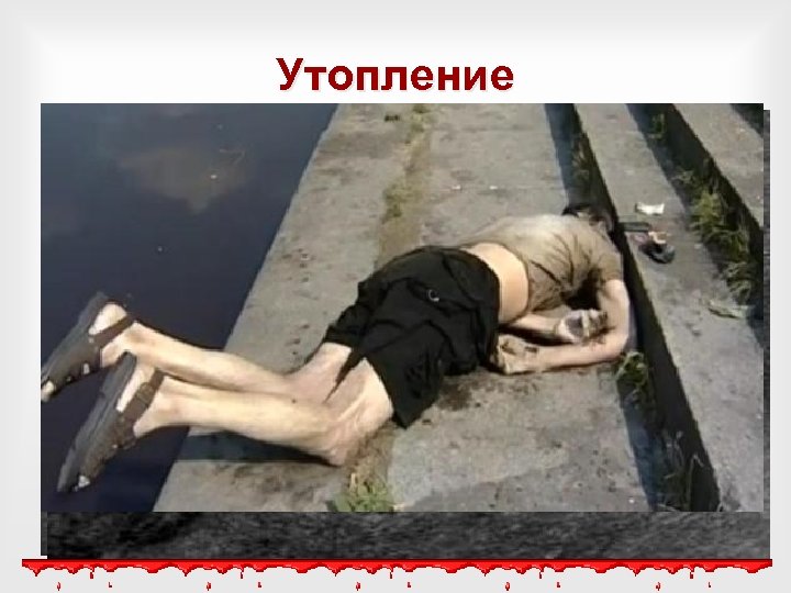 Утопление 