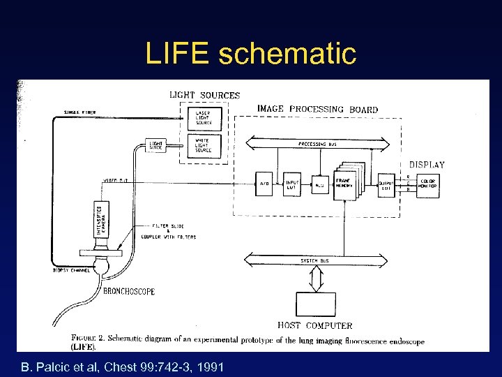 LIFE schematic B. Palcic et al, Chest 99: 742 -3, 1991 
