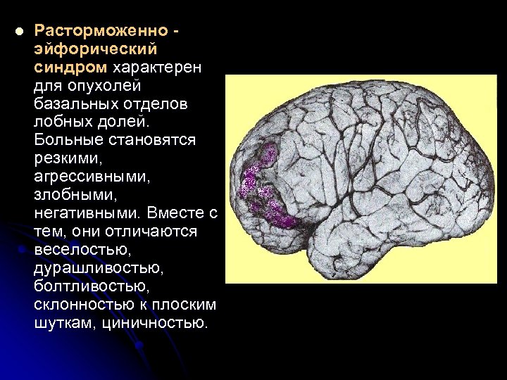 l Расторможенно эйфорический синдром характерен для опухолей базальных отделов лобных долей. Больные становятся резкими,