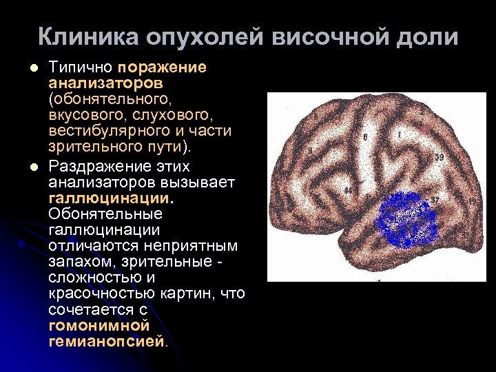 Опухоль головного мозга презентация