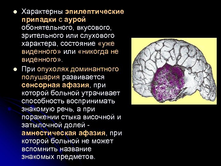 l l Характерны эпилептические припадки с аурой обонятельного, вкусового, зрительного или слухового характера, состояние