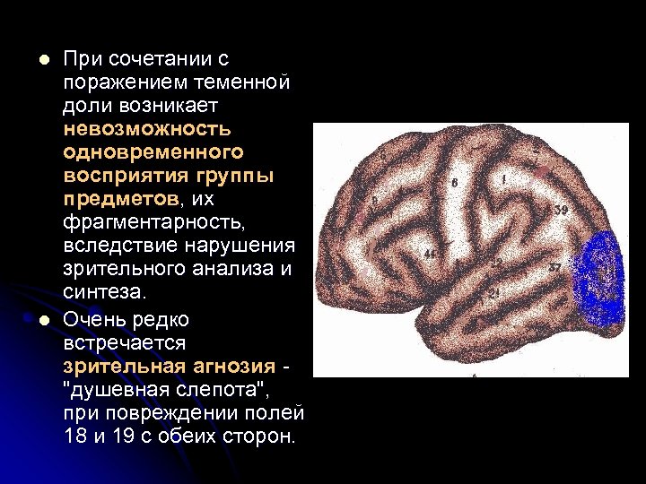 l l При сочетании с поражением теменной доли возникает невозможность одновременного восприятия группы предметов,