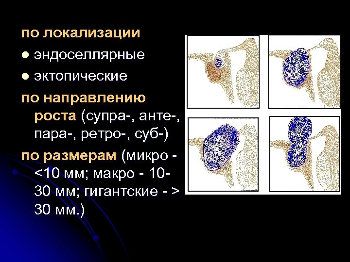 по локализации l эндоселлярные l эктопические по направлению роста (супра-, анте-, пара-, ретро-, суб-)