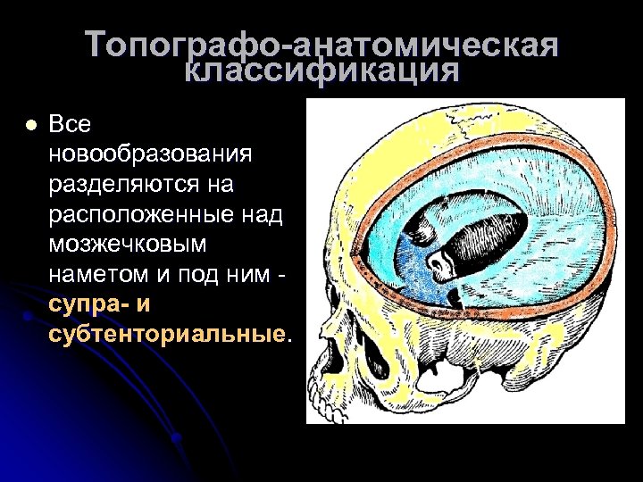 Топографо-анатомическая классификация l Все новообразования разделяются на расположенные над мозжечковым наметом и под ним