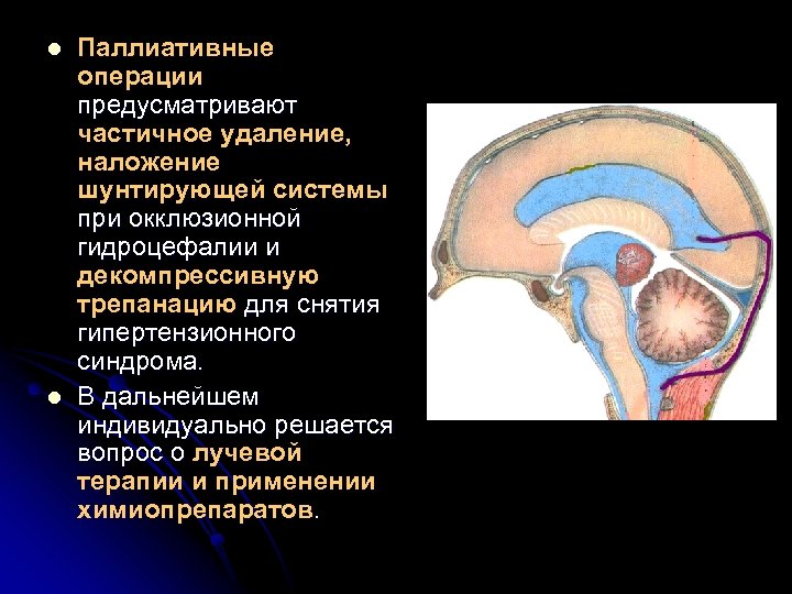l l Паллиативные операции предусматривают частичное удаление, наложение шунтирующей системы при окклюзионной гидроцефалии и