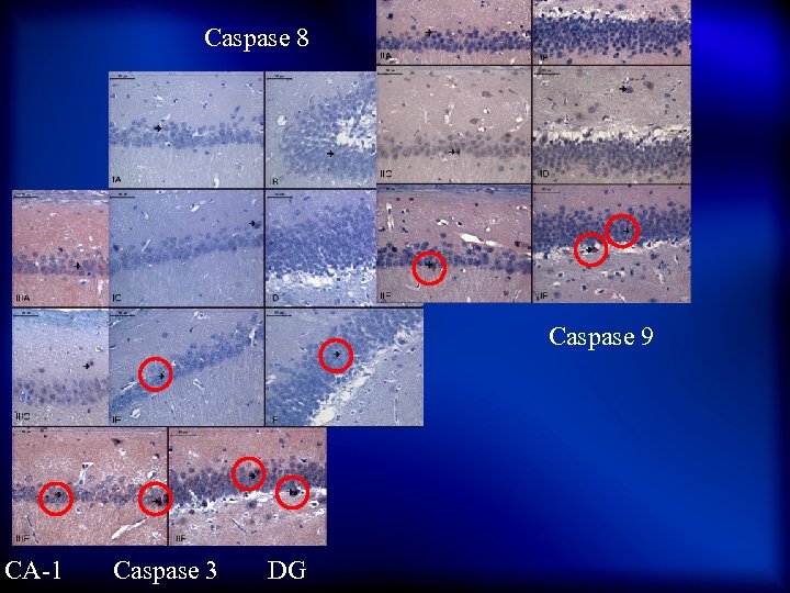 Caspase 8 Caspase 9 CA-1 Caspase 3 DG 