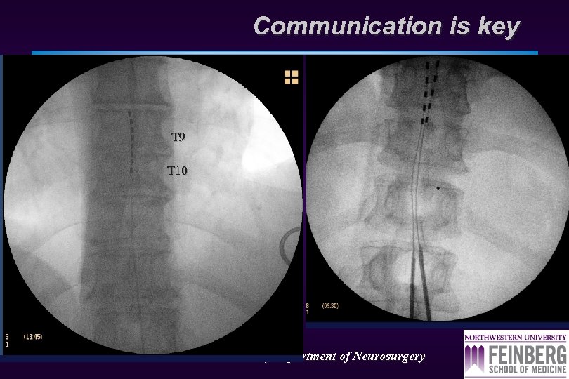 Communication is key T 9 T 10 Northwestern University Department of Neurosurgery 
