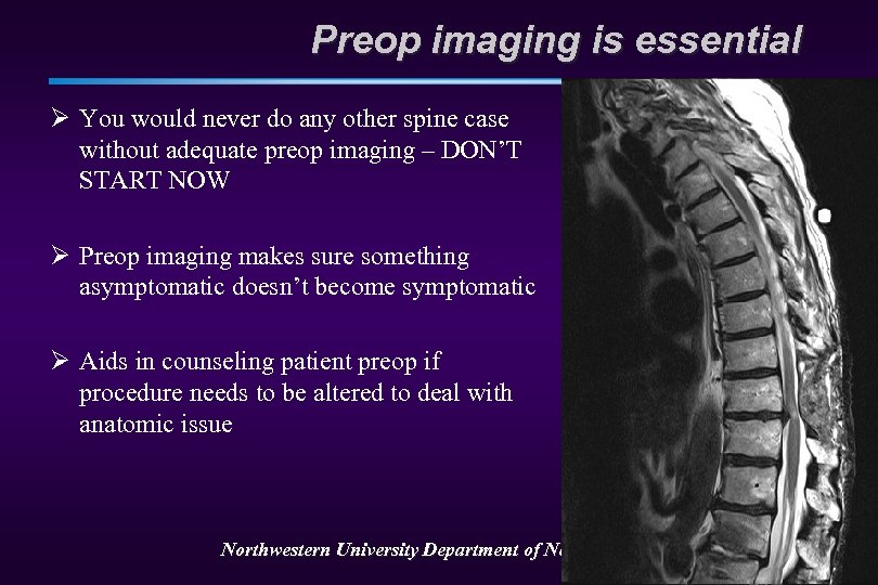 Preop imaging is essential Ø You would never do any other spine case without