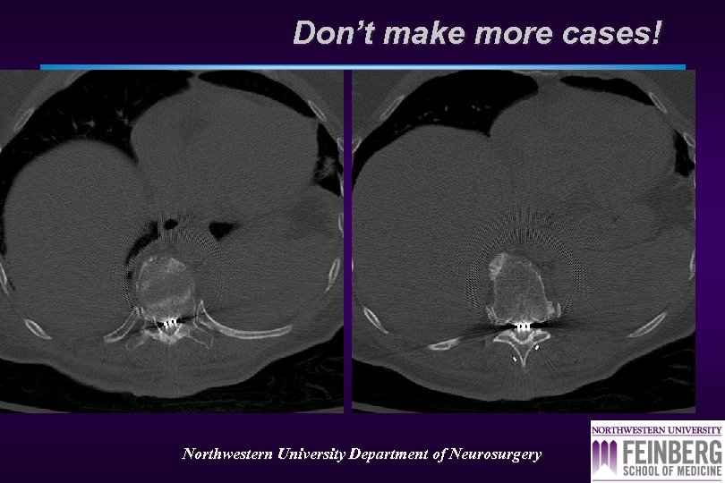 Don’t make more cases! Northwestern University Department of Neurosurgery 