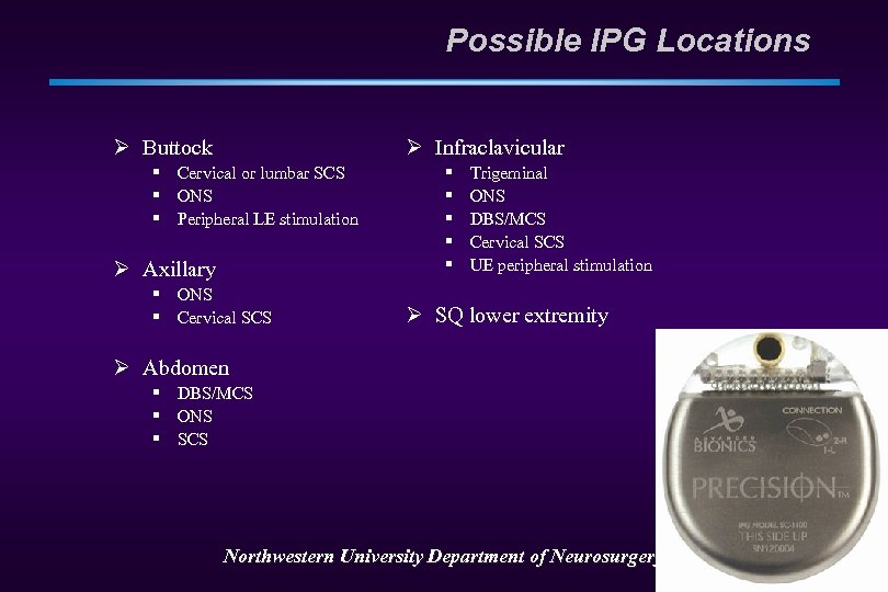 Possible IPG Locations Ø Buttock Ø Infraclavicular § Cervical or lumbar SCS § ONS