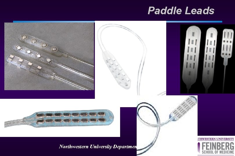 Paddle Leads Northwestern University Department of Neurosurgery 