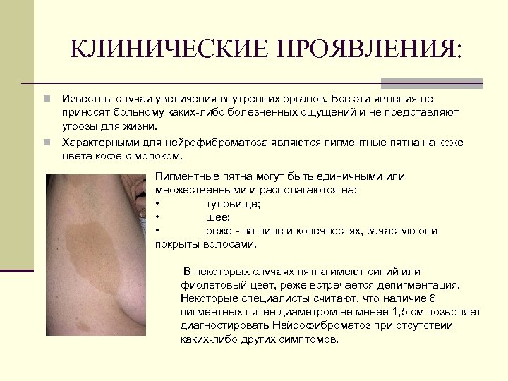 КЛИНИЧЕСКИЕ ПРОЯВЛЕНИЯ: Известны случаи увеличения внутренних органов. Все эти явления не приносят больному каких-либо