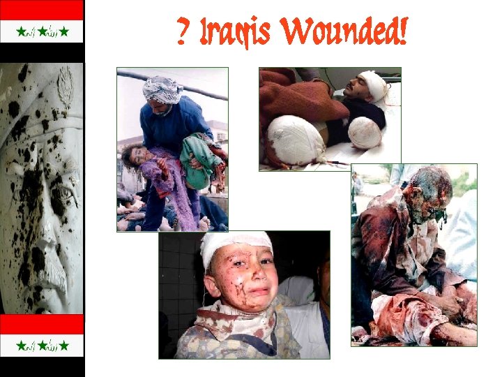? Iraqis Wounded! 