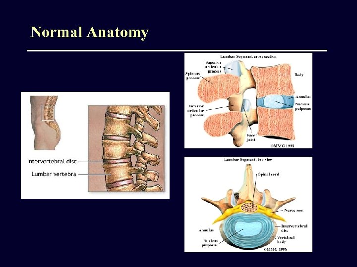 Normal Anatomy 