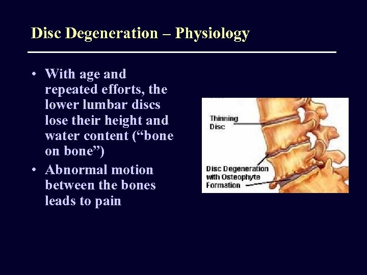 Disc Degeneration – Physiology • With age and repeated efforts, the lower lumbar discs