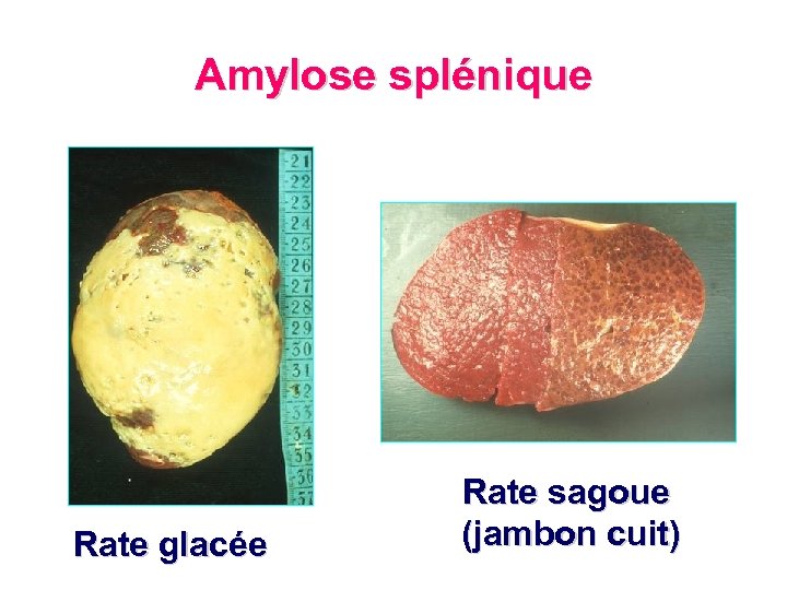 Amylose splénique Rate glacée Rate sagoue (jambon cuit) 