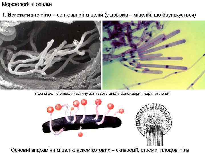 Морфологічні ознаки 1. Вегетативне тіло – септований міцелій (у дріжжів – міцелій, що брунькується)