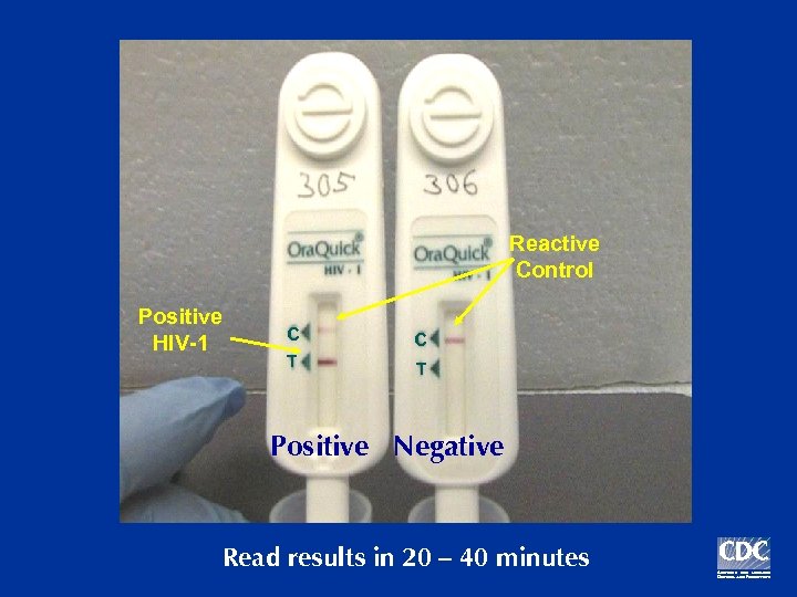 Reactive Control Positive HIV-1 C C T T Positive Negative Read results in 20