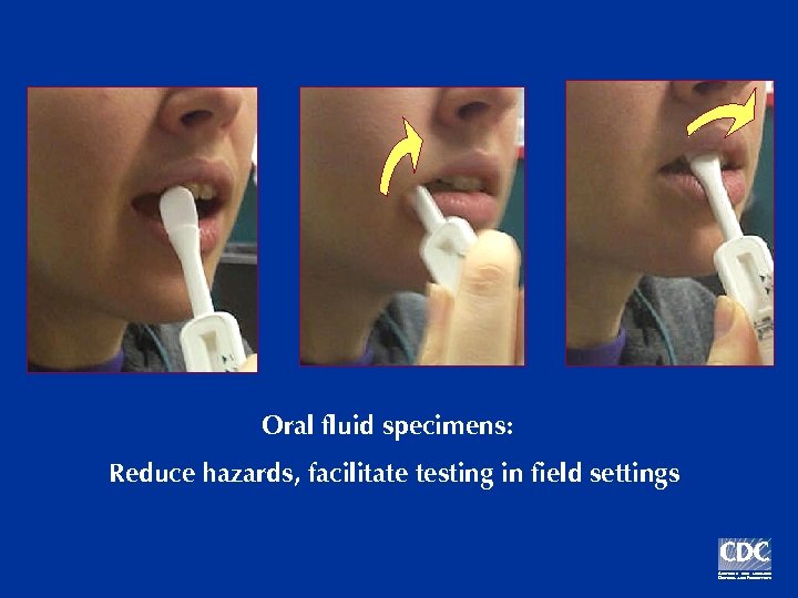 Oral fluid specimens: Reduce hazards, facilitate testing in field settings 