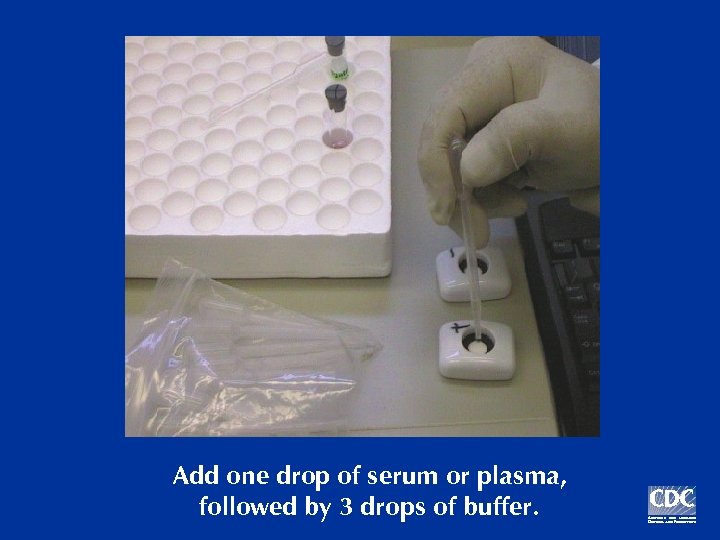 Add one drop of serum or plasma, followed by 3 drops of buffer. 