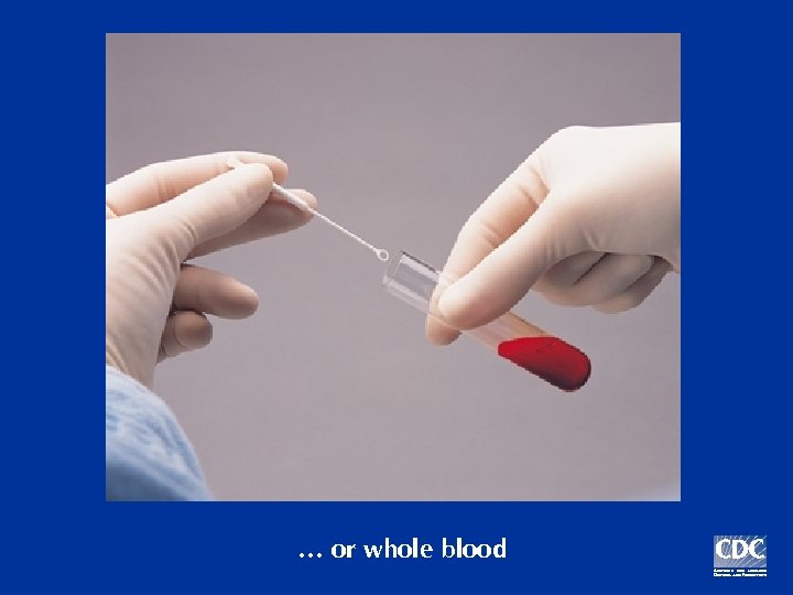 … or whole blood 