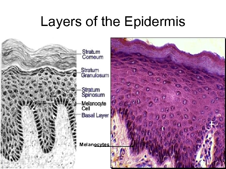 Layers of the Epidermis Melanocytes 