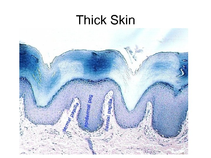 Thick Skin 