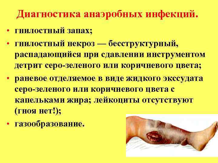 Диагностика анаэробных инфекций. • гнилостный запах; • гнилостный некроз — бесструктурный, распадающийся при сдавлении