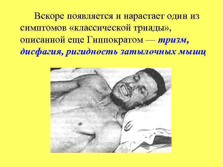 Вскоре появляется и нарастает один из симптомов «классической триады» , описанной еще Гиппократом —