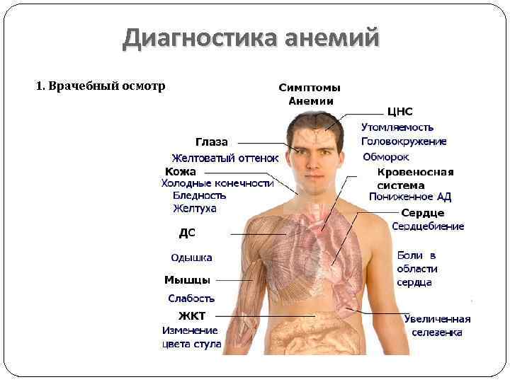 Диагностика анемий 1. Врачебный осмотр 