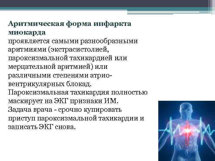 Аритмическая форма инфаркта миокарда проявляется самыми разнообразными аритмиями (экстрасистолией, пароксизмальной тахикардией или мерцательной аритмией)