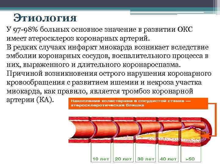 Острый коронарный синдром причины