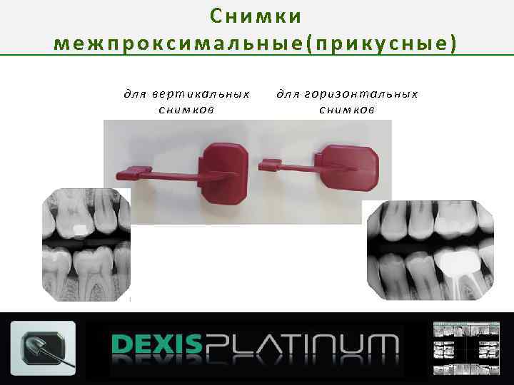 Снимки межпроксимальные(прикусные) для вертикальных снимков для горизонтальных снимков 