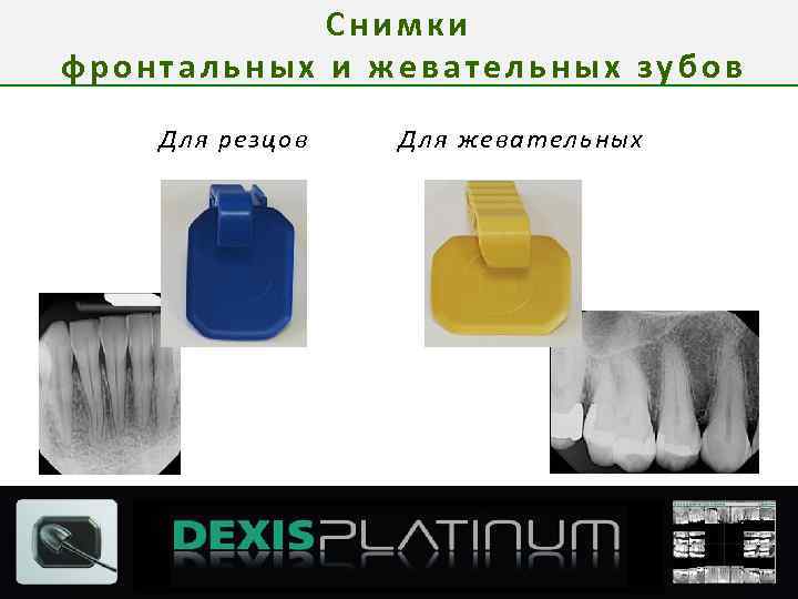 Снимки фронтальных и жевательных зубов Для резцов Для жевательных 