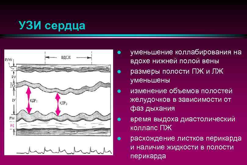 Коллабирование