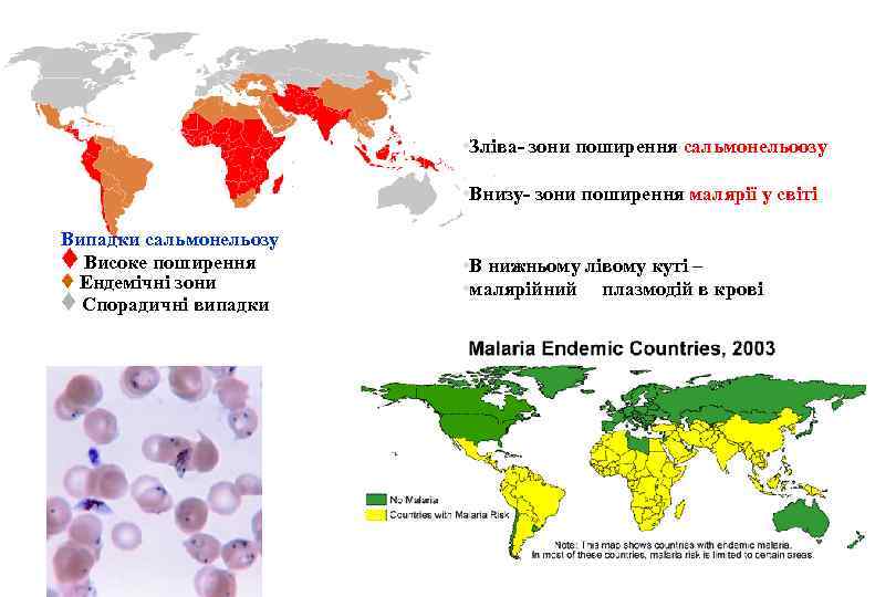  • Зліва- зони поширення сальмонельоозу • Внизу- зони поширення малярії у світі Випадки
