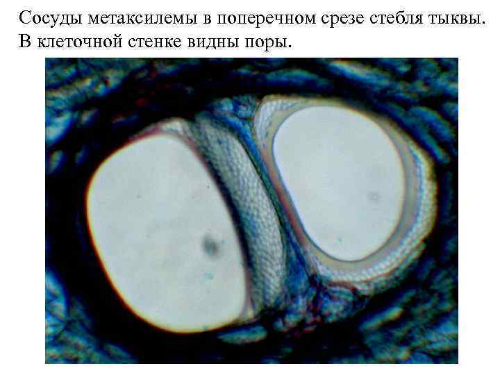 Сосуды метаксилемы в поперечном срезе стебля тыквы. В клеточной стенке видны поры. 