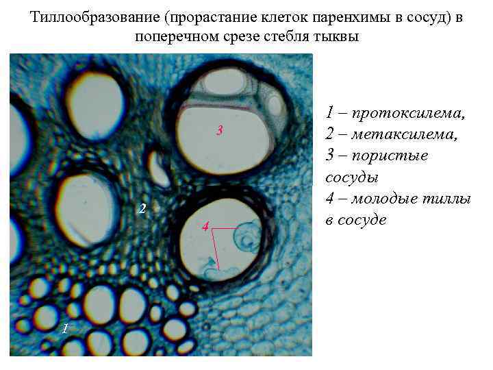 Тиллообразование (прорастание клеток паренхимы в сосуд) в поперечном срезе стебля тыквы 3 2 4