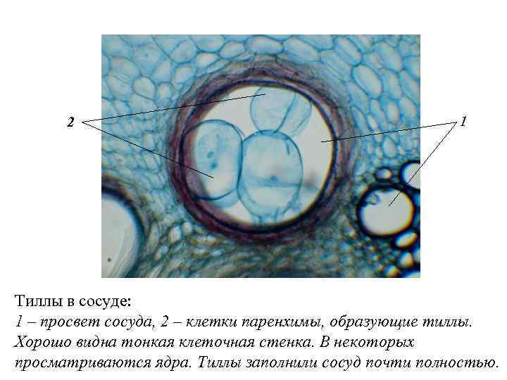 2 1 Тиллы в сосуде: 1 – просвет сосуда, 2 – клетки паренхимы, образующие