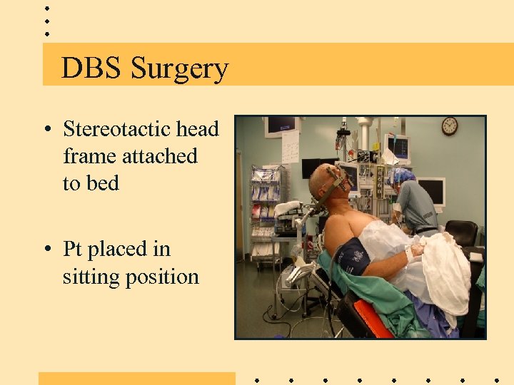 DBS Surgery • Stereotactic head frame attached to bed • Pt placed in sitting