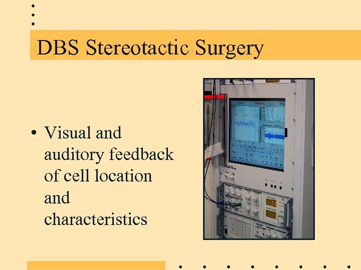 DBS Stereotactic Surgery • Visual and auditory feedback of cell location and characteristics 