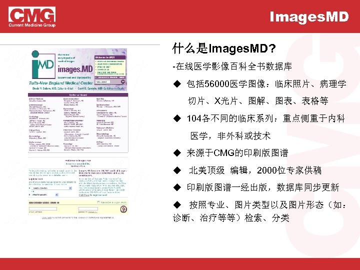 Images. MD 什么是Images. MD? -在线医学影像百科全书数据库 ◆ 包括 56000医学图像：临床照片、病理学 screenshot 切片、X光片、图解、图表、表格等 ◆ 104各不同的临床系列：重点侧重于内科 医学，非外科或技术 ◆