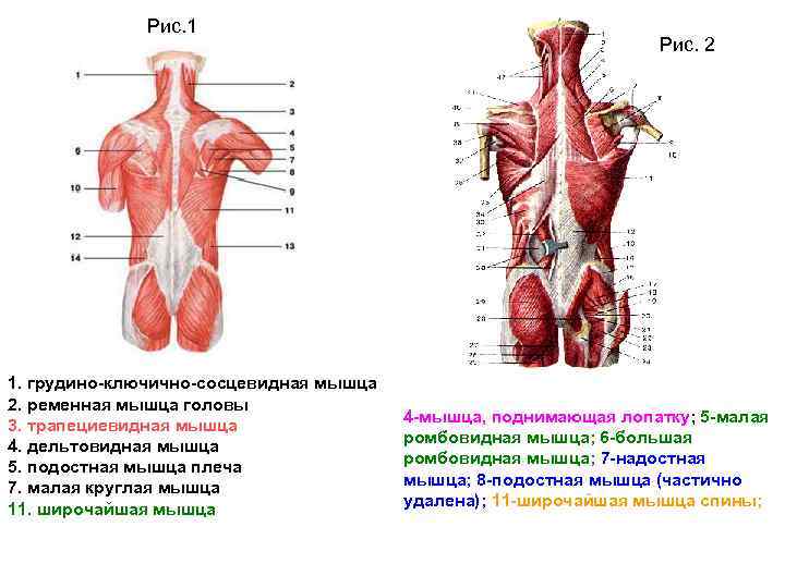 Рис. 1 1. грудино-ключично-сосцевидная мышца 2. ременная мышца головы 3. трапециевидная мышца 4. дельтовидная