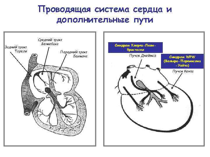 Проводящая система сердца и дополнительные пути Задний тракт Тореля Средний тракт Венкебаха Передний тракт