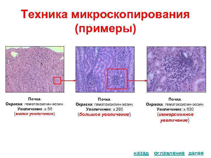 Техника микроскопирования (примеры) Почка. Окраска: гематоксилин-эозин. Увеличение: х 56 (малое увеличение). Почка. Окраска: гематоксилин-эозин.